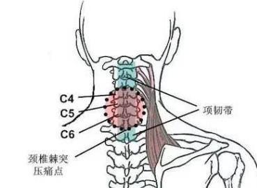 再见颈椎病!试试"斜方肌抻展"锻炼,比上医院按摩效果还要好