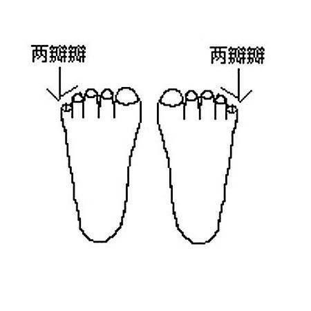 脚趾两瓣,又叫"跰趾"或者"复甲,在医学上称作瓣状甲或小脚趾复形