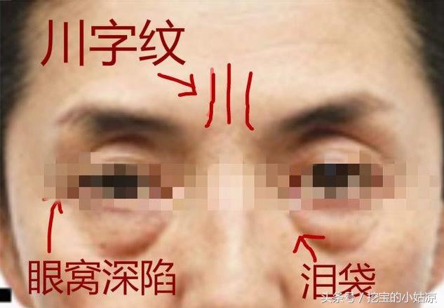 这种面相福气最差,财运最差,婚姻最差,特别是女人一定得瞧瞧!