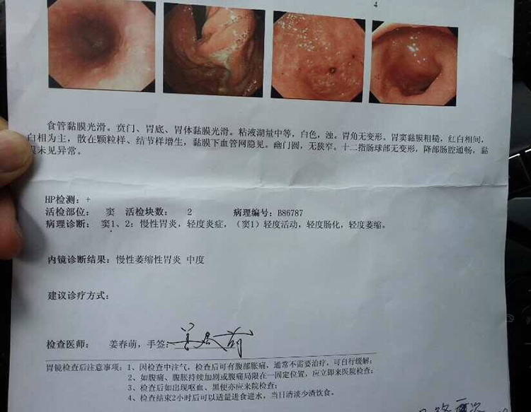 胃病,胃炎,吃药后反而加重,中医一个小方帮了我