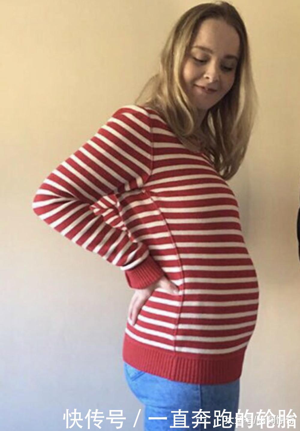 女子肚子隆起25cm以为怀孕, 医生检查后 里面有7个"葫芦娃"