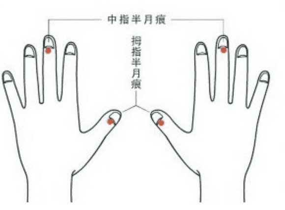 手指上的月牙痕代表什么?