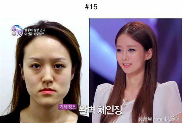 18个韩国人整形的例子,证实现在不需要投胎也能变天菜