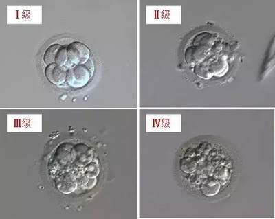 试管婴儿鲜胚,冻胚,囊胚移植的优劣和成功率