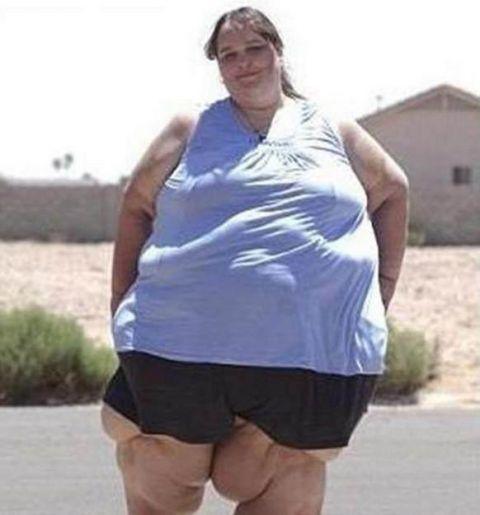这个女人,体重超过1000斤,胖到生活都不能自理了