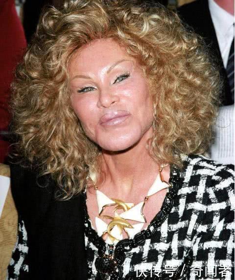 威尔顿斯坦(jocelyn wildenstein)就是经典例子.