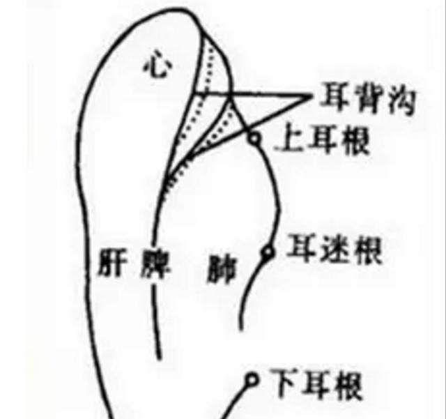 降压沟是一个便于操作的地方,在耳轮后面有一个手可以触摸到的沟,这