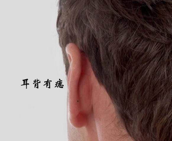 痣的命运与你的位置动画表情包苹果微信看看,相伴你的痣长在图片