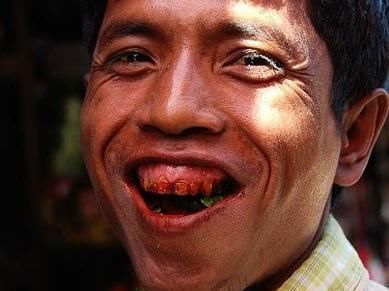 50岁男子每天吃三包槟榔,医生检查口腔时惊呆