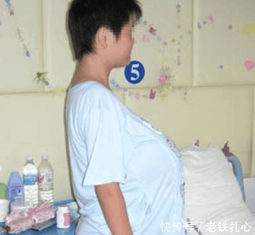 13岁网名胸部大的异常,受尽女生嘲笑,手术过后qq女孩的字舞炫五个同学图片
