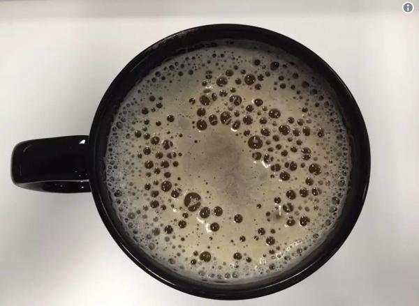 密集恐惧症究竟怎么回事?