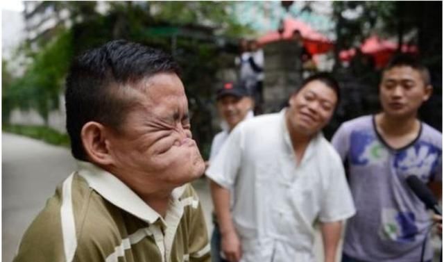 世界上最丑的人,特别像首富,网友:哪个首富?