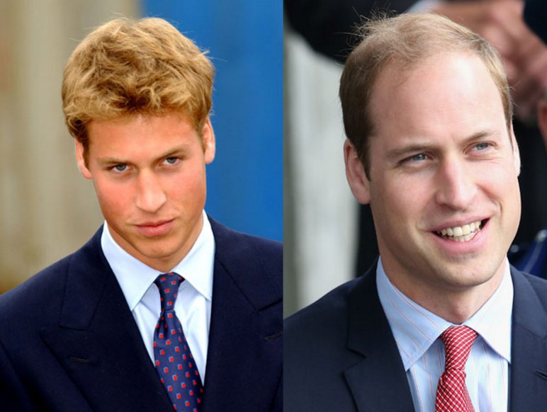 英国威廉王子换了新发型,他在要秃的路上越走越远了