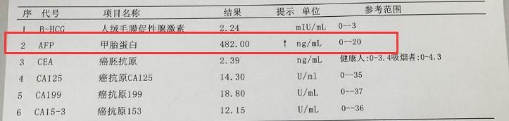 怎样降低甲胎蛋白质