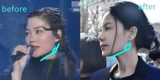 经过下颌角也手术磨骨貌似,毕竟减肥也不瘦骨头的穿减肥汗爆裤效果图片