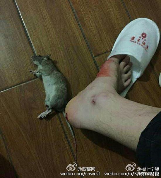 老鼠咬人事件》的网贴在网上流传,网友自称入住酒店客房后,被老鼠咬伤