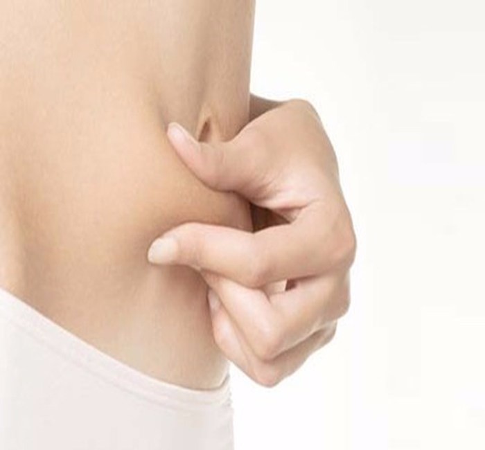 做腰腹部吸脂适应症和不适合人群都有哪些?