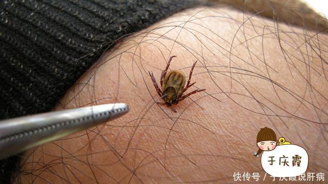 看到身上有个"黑点"可别扣!已经有人掉进"陷阱"