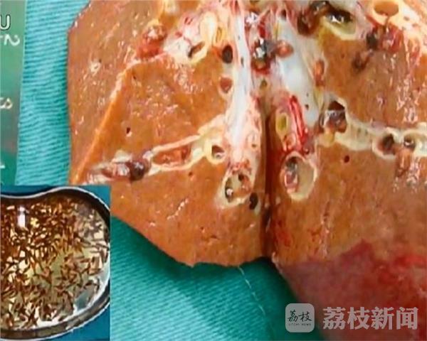 淡水鱼生吃不得 小心食入肝吸虫