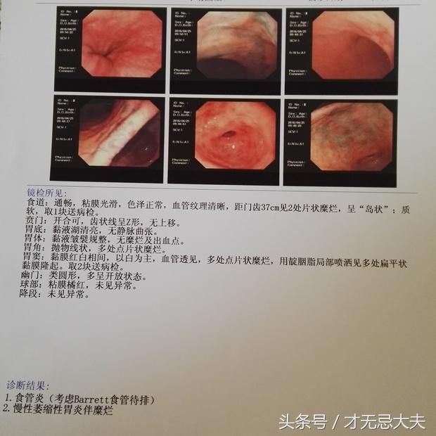 慢性萎缩性胃炎伴随着糜烂能治好吗?有什么好的方法?