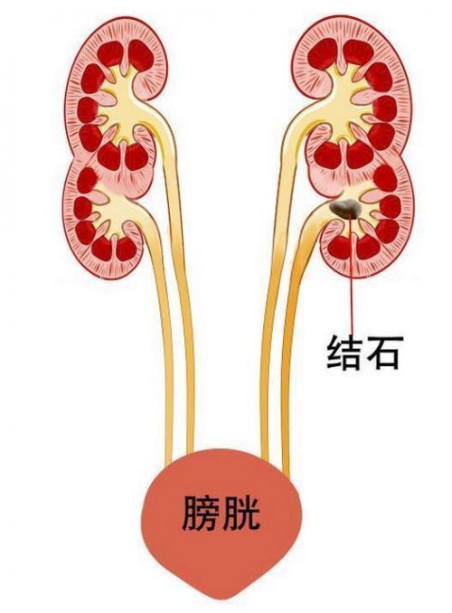 我们来看看人体正常的肾脏长什么样子