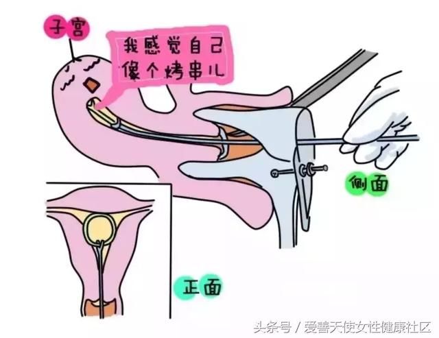 上环是上在哪里 上环从哪开始上
