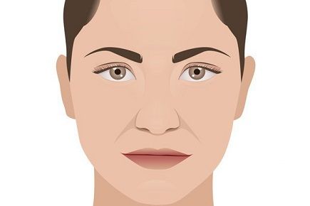 怎么去除法令纹最好 去除法令纹6种最好方法