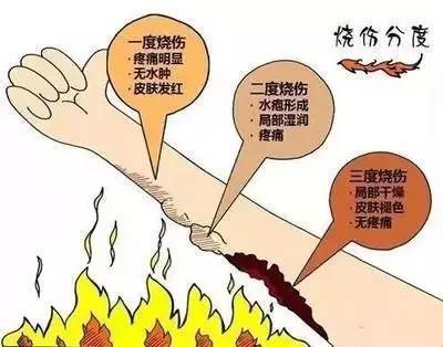 常熟火灾22人遇难!火灾发生后,除了逃生,这件事更重要