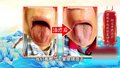 73岁肿瘤患者化疗后食欲不振、体重下降，中医调理两周恢复