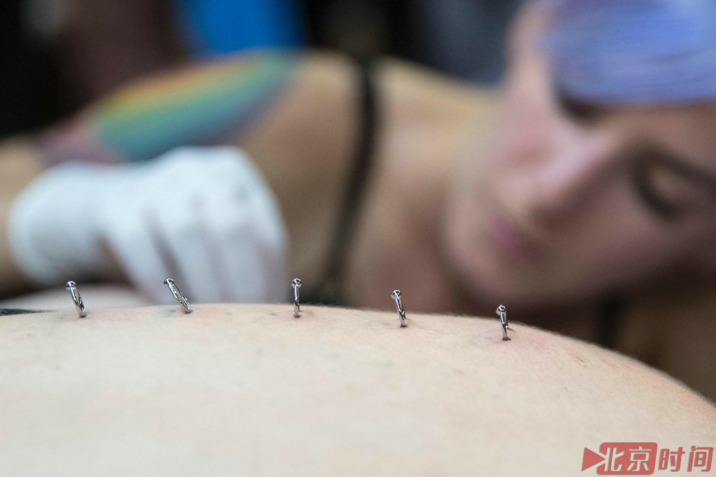 图为大会当天的穿刺艺术。