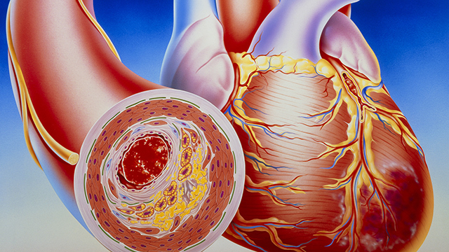 《养生堂》20180122重启人生之拯救心脏 《养生堂》20180122重启人生之拯救心脏