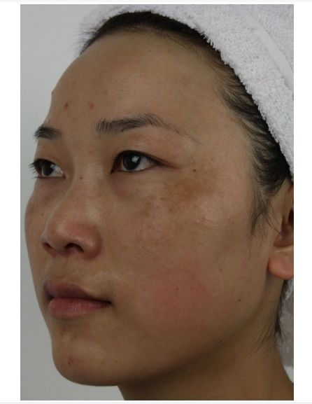 蜂蜜掺入家里这液体能祛斑?女人不知,每晚这样