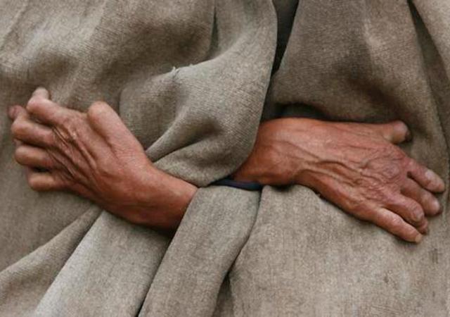 麻风病真的那么可怕吗?国家是否免费诊治?