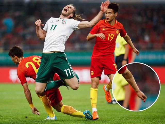 中国球员们该如何遮盖文身?