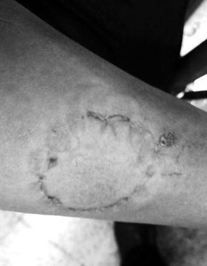 男子北京地铁上猥亵女乘客 被捕时咬伤民警 男子北京地铁上猥亵女乘客 被捕时咬伤民警