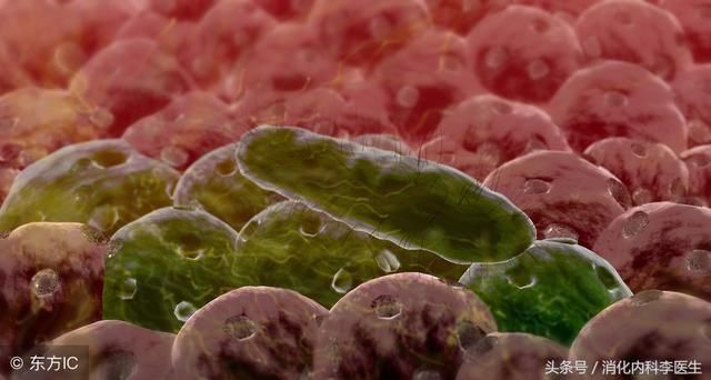 患有胃病,要不要根除幽门螺杆菌治疗?来听消化
