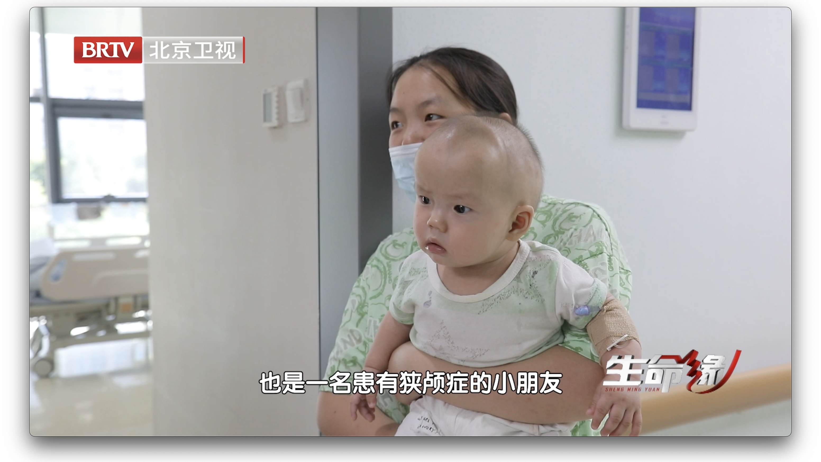 孩子头部凸出,“睡一睡”就好了?千万别忽视,可能是狭颅症 孩子头部凸出,“睡一睡”就好了?千万别忽视,可能是狭颅症