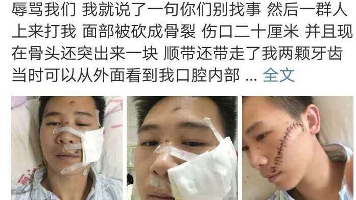 3起打游客事件!丽江要求旅游业“刮骨疗毒” 3起打游客事件!丽江要求旅游业“刮骨疗毒”