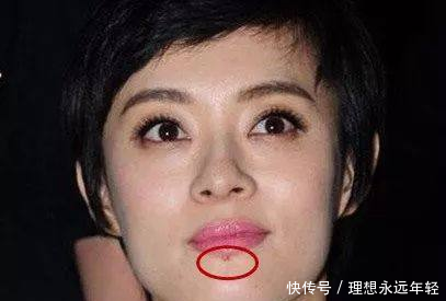 这10位明星脸上都有疤,郑爽被怀疑整容,杨幂自