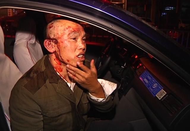 贵阳一"的哥"莫名挨毒打,真相却是贵阳老百姓的一大痛点!