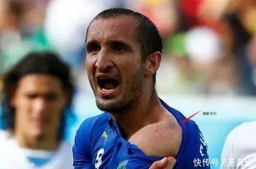 苏神世界杯咬人,迫使亚足联改规则:咬人者吃红