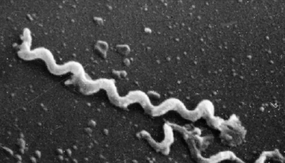 几百个无辜的人痛苦孤独的死去,换来梅毒研究