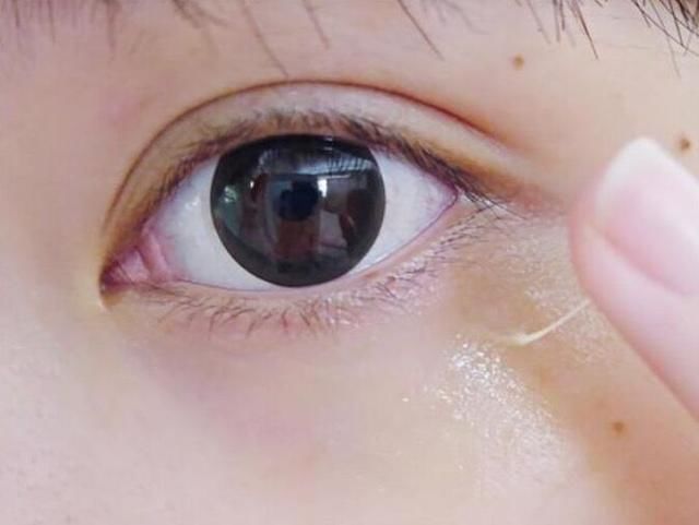 白醋加上它,睡前擦一下,眼袋马上消失