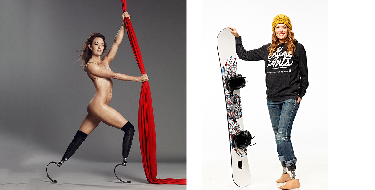 截肢失聪内脏坏死 本是废人却成滑雪冠军