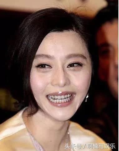 女明星们做梦都想删掉的笑崩照:杨幂露牙床,蔡