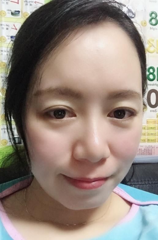 脸上长斑是因为身体缺它,睡前脸上抹层粉,祛