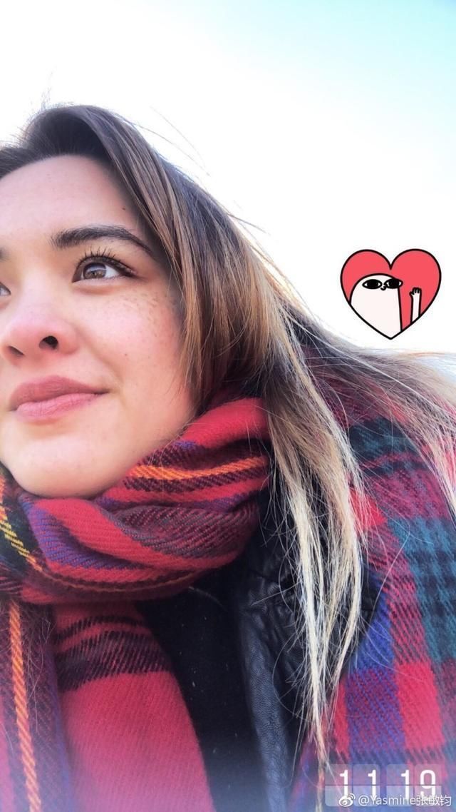 钟丽缇大女儿晒近照,不介意脸上斑点,帅气男友