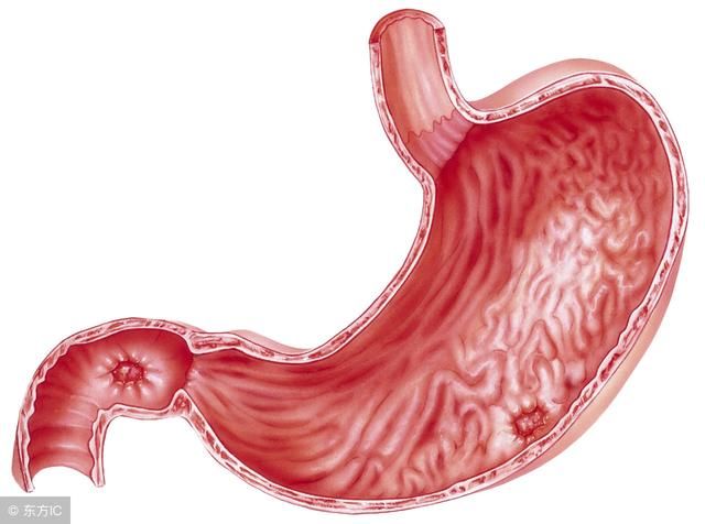 四个实例,告诉你幽门螺旋杆菌如何传播