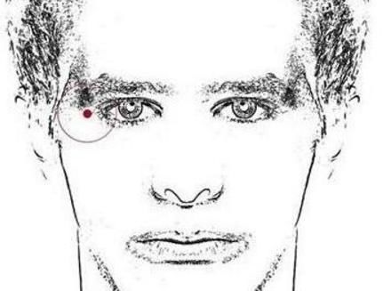 用什么可以去脸上的痣 t0116de1617a95b9a0b.jpg?size=440x327