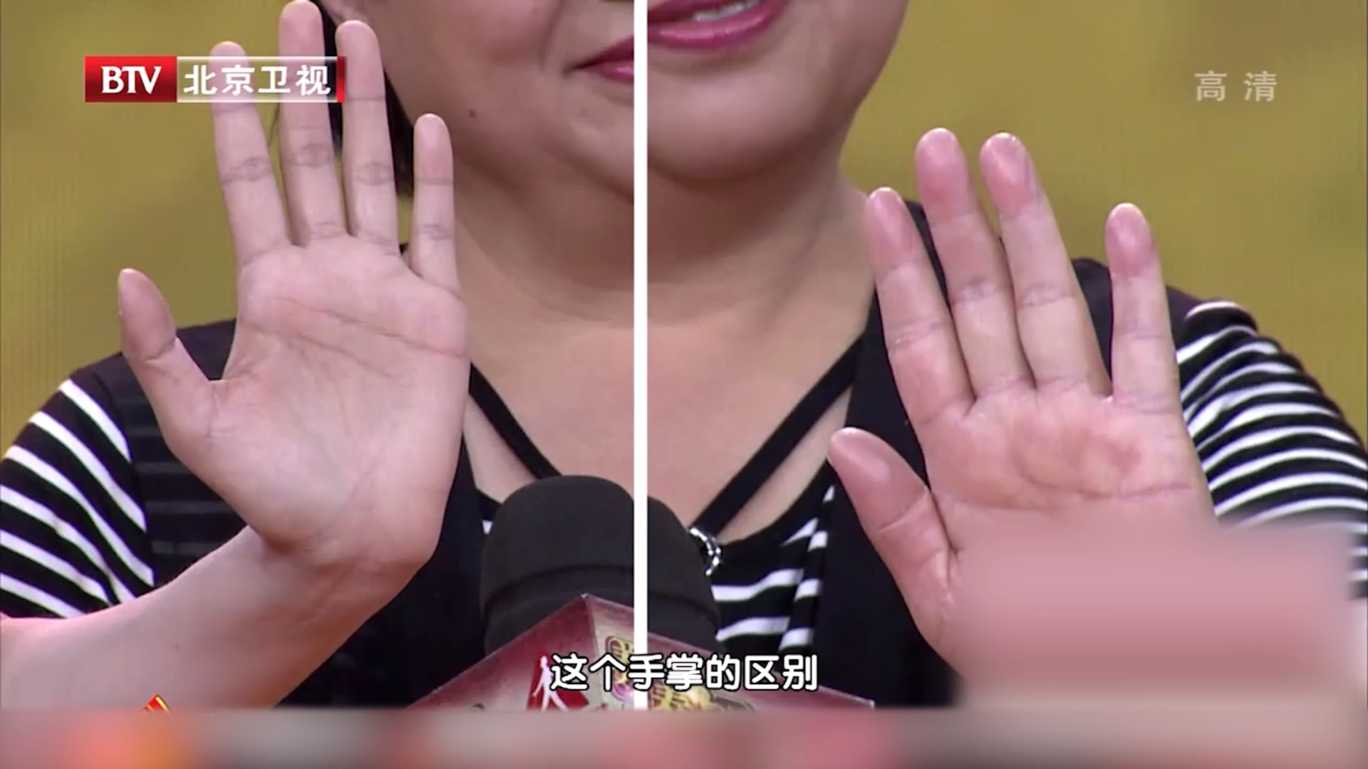 血瘀患者往往更容易得肿瘤，手部出现这些表现需要警惕！